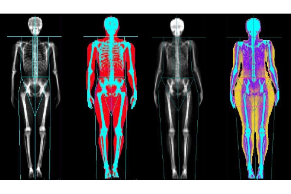 Measuring body fat percentage: It's an accuracy thing - XbodyConcepts